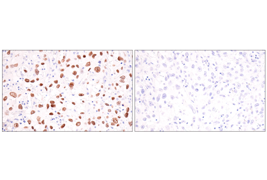 Immunohistochemistry Image 3: p40 (BC28) Mouse Monoclonal Antibody