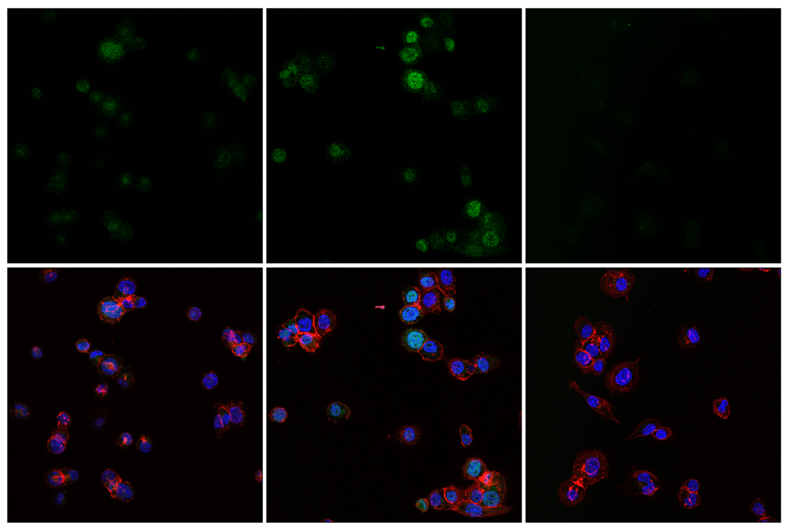 Immunofluorescence Image 1: Phospho-NF-kappaB p65 (Ser529) (E3K3J) Rabbit Monoclonal Antibody
