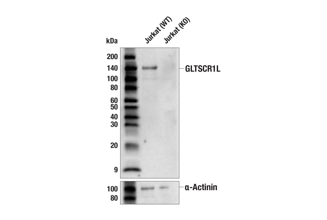 Western Blotting Image 2: GLTSCR1L (E4D9W) Mouse Monoclonal Antibody