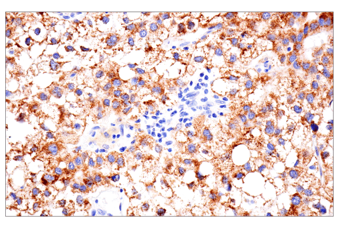 Immunohistochemistry Image 4: AMACR (F7T6V) Rabbit Monoclonal Antibody