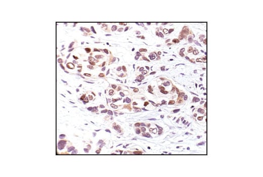 undefined Image 13: p53 Antibody Sampler Kit