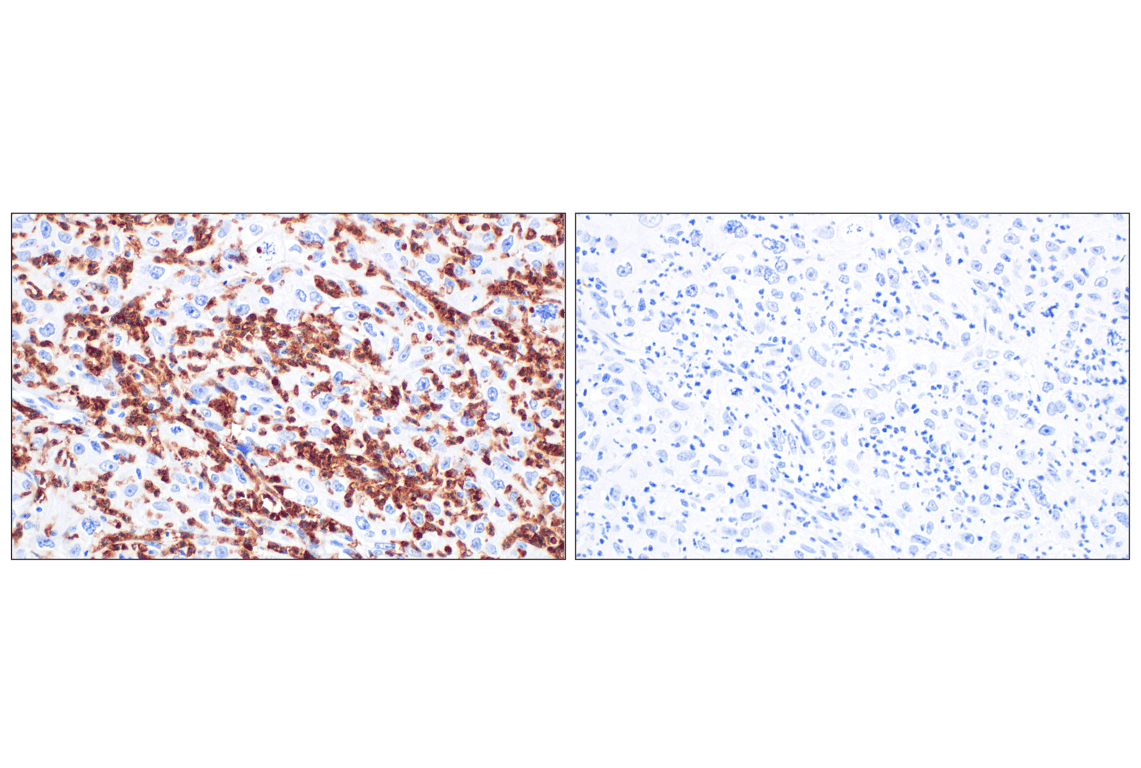 Immunohistochemistry Image 6: CD89/FCAR (F1T9J) Rabbit Monoclonal Antibody