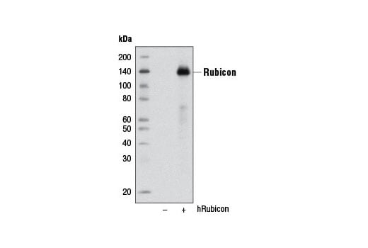 undefined Image 14: Autophagy Vesicle Nucleation Antibody Sampler Kit