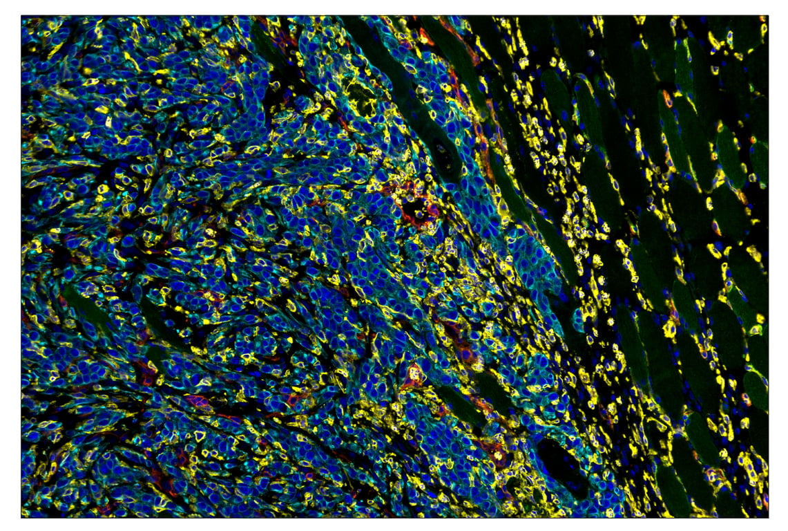 Immunohistochemistry Image 1: Pan-Keratin (Type I) (E6S1S) & CO-0072-750 SignalStar<sup>™</sup> Oligo-Antibody Pair