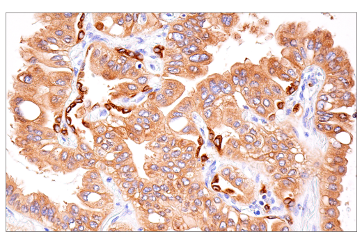 Immunohistochemistry Image 3: Rab27B (E4V3O) Rabbit Monoclonal Antibody