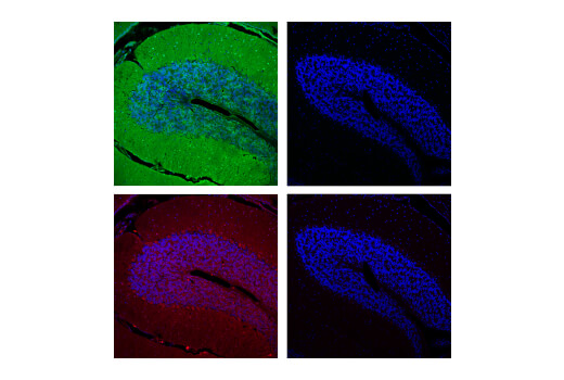 Immunofluorescence Image 1: mCherry (E5D8F) Rabbit Monoclonal Antibody