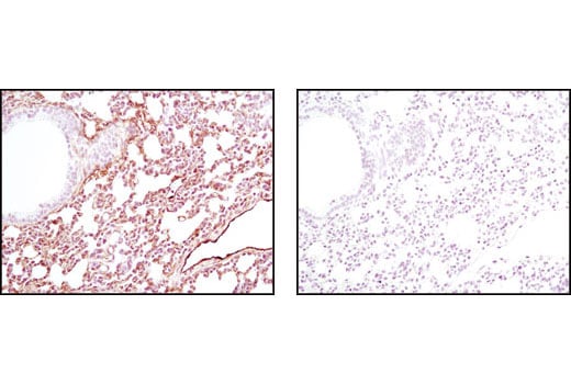 Immunohistochemistry Image 3: Caveolin-1 (D46G3) Rabbit Monoclonal Antibody