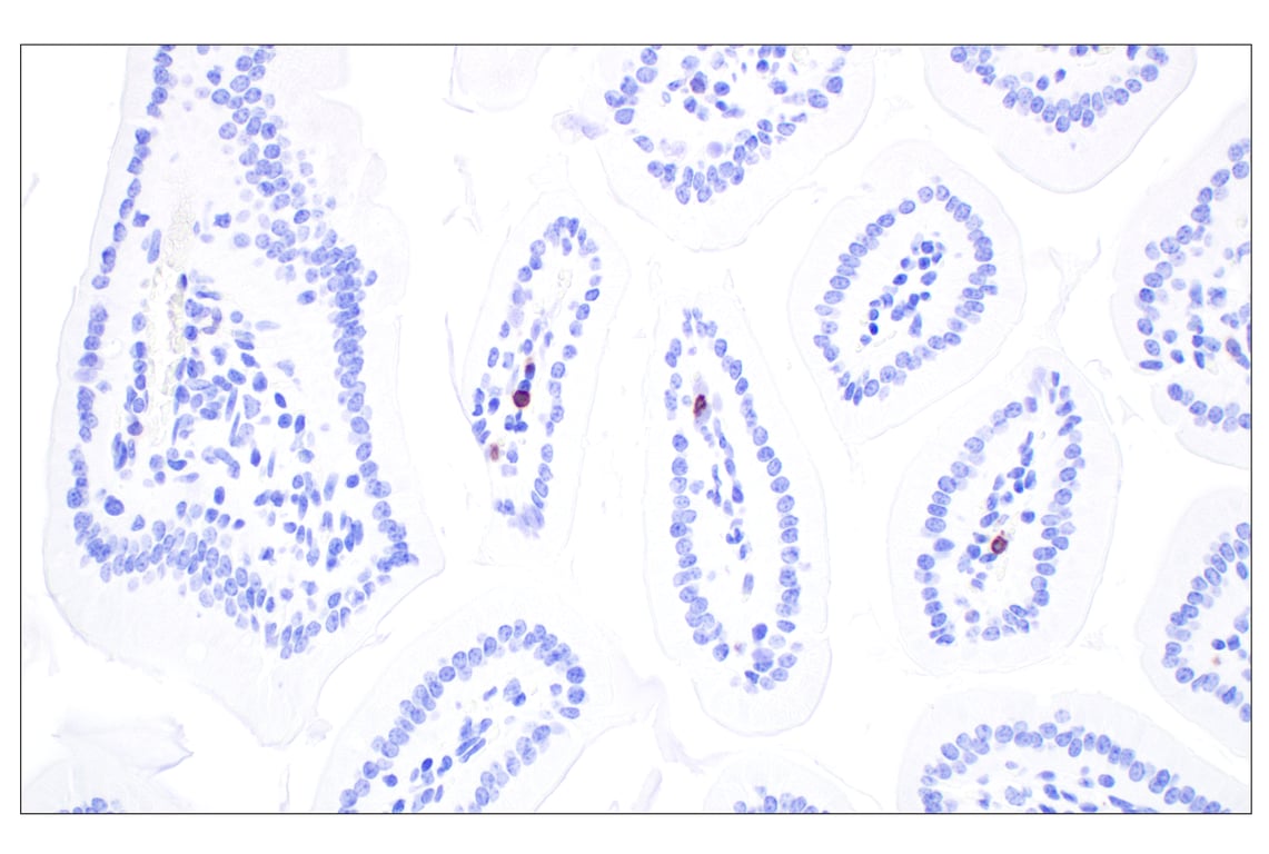 Immunohistochemistry Image 4: CD5 (E6N9S) Rabbit Monoclonal Antibody