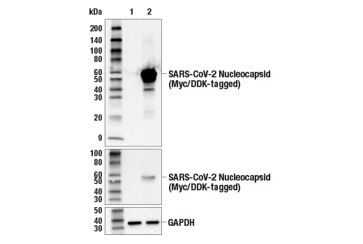 Western Blotting Image 3: SARS-CoV-2 Nucleocapsid Protein (E9L7H) Rabbit Monoclonal Antibody
