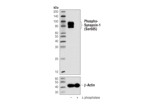 Phospho-Synapsin-1 (Ser605) (D4B9I) Rabbit mAb | Cell