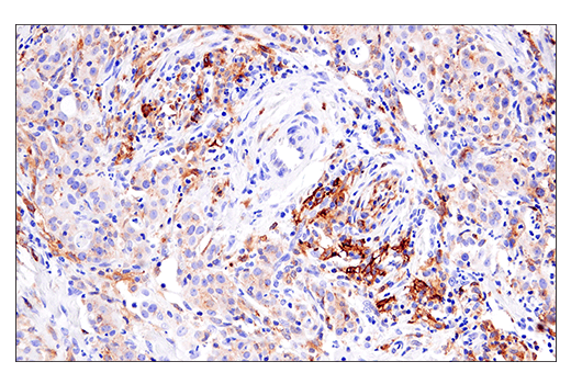 Immunohistochemistry Image 2: HLA-DRA (E9R2Q) XP<sup>®</sup> Rabbit mAb (BSA and Azide Free)