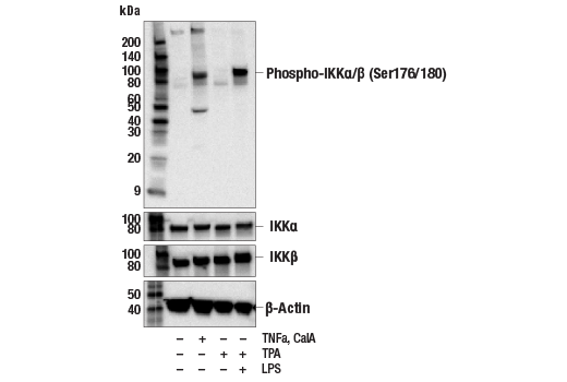 Western Blotting Image 2: Phospho-IKK alpha/beta (Ser176/180) (16A6) Rabbit Monoclonal Antibody (BSA and Azide Free)