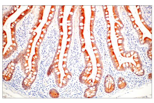 Immunohistochemistry Image 2: GUCY2C (E6I2U) Rabbit Monoclonal Antibody