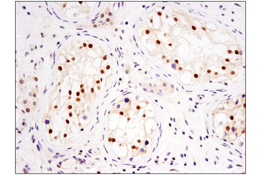 Immunohistochemistry Image 4: DNMT3A (D23G1) Rabbit Monoclonal Antibody