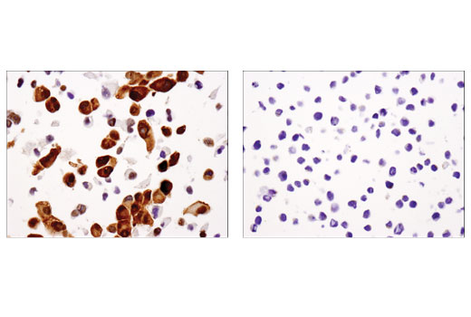 Immunohistochemistry Image 8: YAP (D8H1X) Rabbit Monoclonal Antibody (BSA and Azide Free)