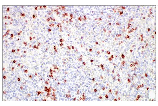 Immunohistochemistry Image 2: CD7 (E4G1Q) Rabbit Monoclonal Antibody