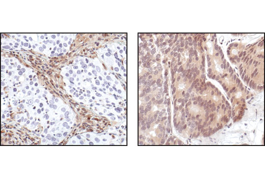 Immunohistochemistry Image 5: PTEN (138G6) Rabbit Monoclonal Antibody (BSA and Azide Free)