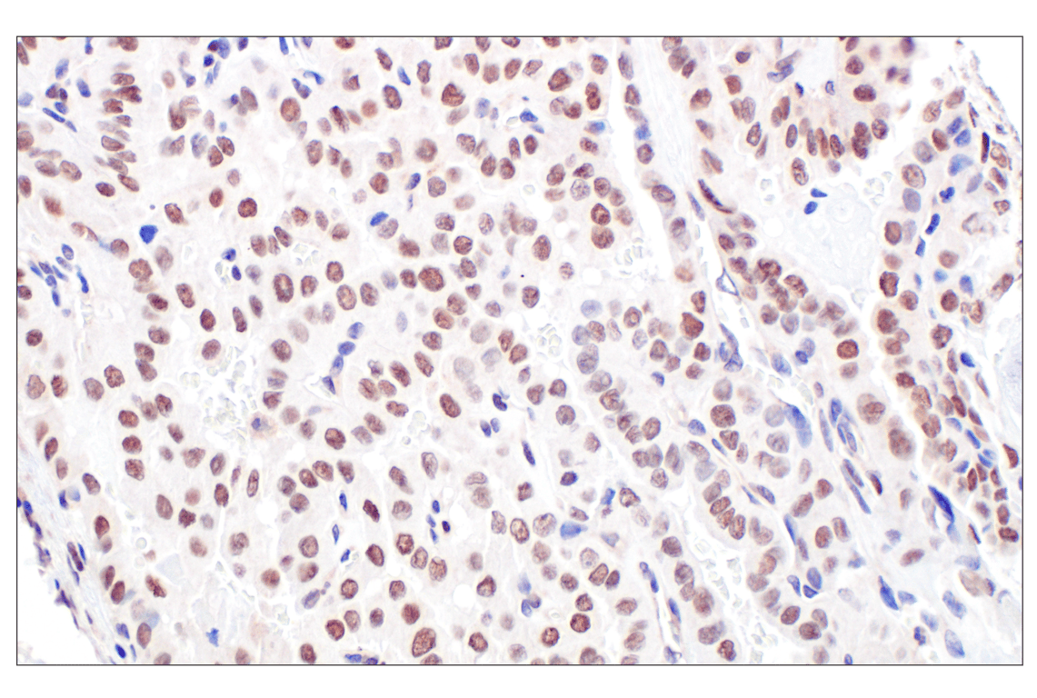 Immunohistochemistry Image 1: TFE3 (F3Z2Q) Rabbit Monoclonal Antibody