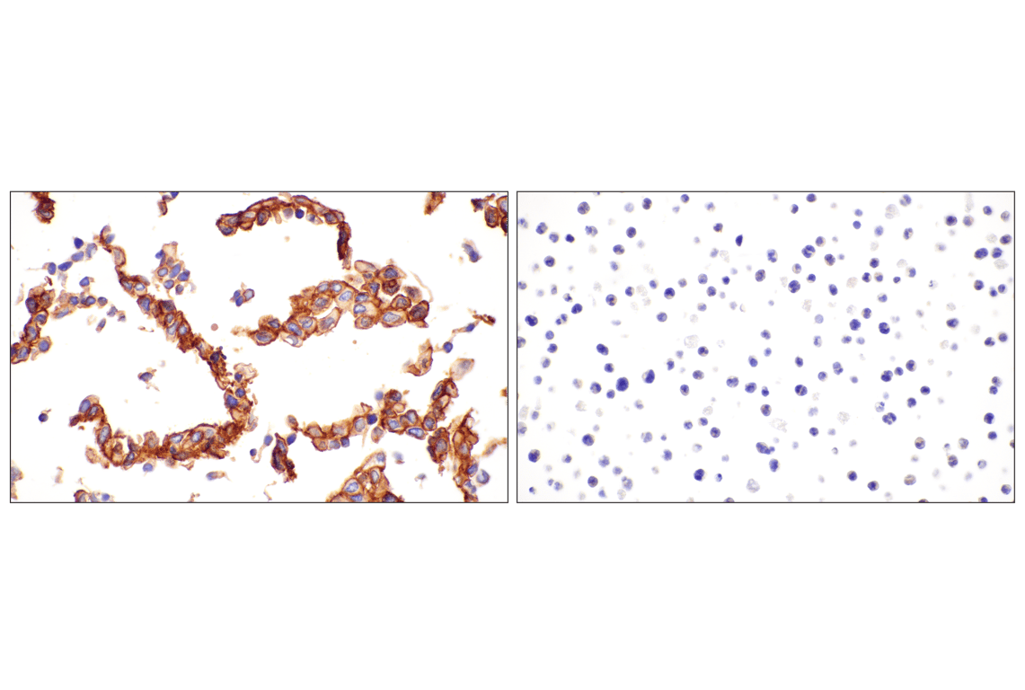 Cytotoxin / Radiophobia【輸入盤】 CD81 (D5O2Q) Rabbit mAb (BSA and Azide Free) | Cell