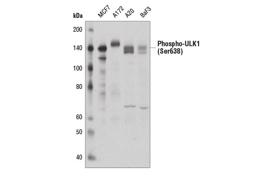 Western Blotting Image 3: Phospho-ULK1 (Ser638) (D8K9O) Rabbit Monoclonal Antibody