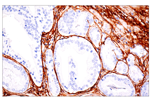 Immunohistochemistry Image 1: COL1A1 (E8F4L) Rabbit Monoclonal Antibody (BSA and Azide Free)