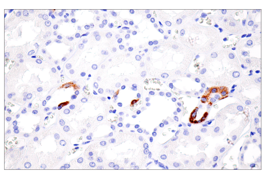 Immunohistochemistry Image 5: CPS1/Hep Par-1 (E9I9U) Rabbit Monoclonal Antibody (BSA and Azide Free)