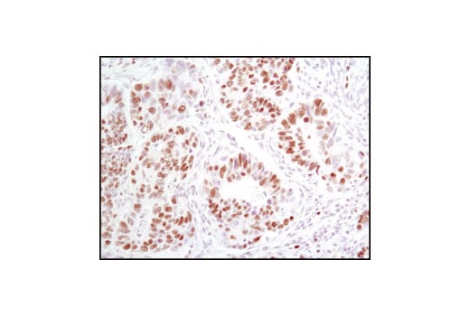 Immunohistochemistry Image 2: MCM2 (D7G11) XP<sup>®</sup> Rabbit mAb (BSA and Azide Free)