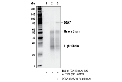 Immunoprecipitation Image 1: DGK alpha (E2Z7V) Rabbit Monoclonal Antibody