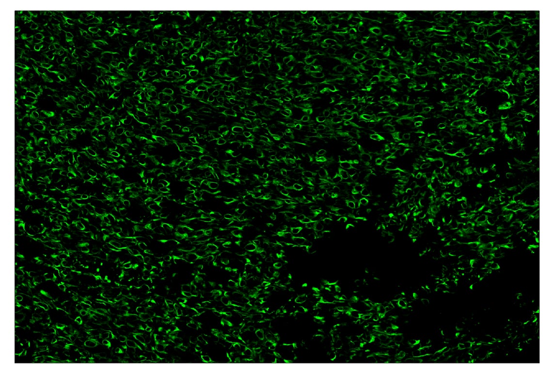 Immunohistochemistry Image 2: Pan-Keratin (Type I) (E6S1S) & CO-0072-647 SignalStar<sup>™</sup> Oligo-Antibody Pair