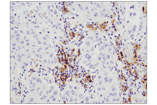 Immunohistochemistry Image 2: CD19 (Intracellular Domain) (D4V4B) Rabbit Monoclonal Antibody