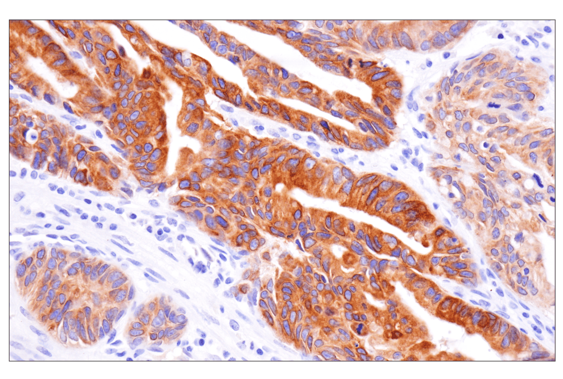 Immunohistochemistry Image 2: KK-LC-1 (F3U6C) Rabbit Monoclonal Antibody (BSA and Azide Free)