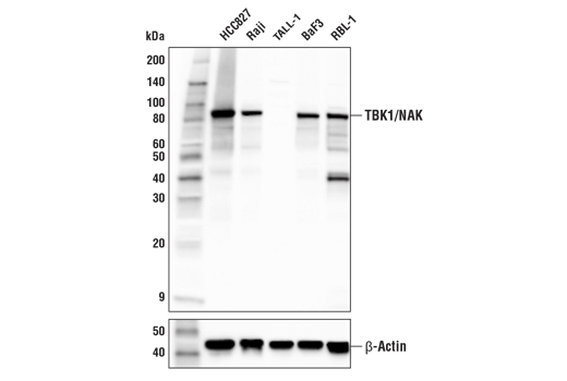 undefined Image 3: PhosphoPlus<sup>®</sup> TBK1/NAK (Ser172) Antibody Duet
