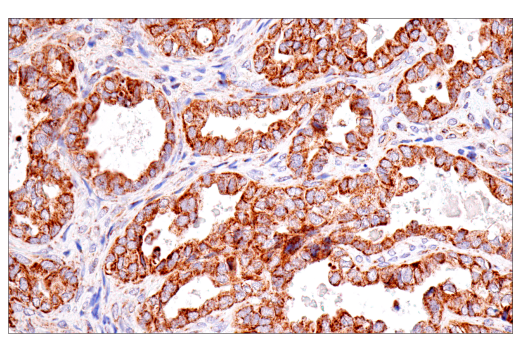 Immunohistochemistry Image 4: SDHB (E3H9Z) Rabbit Monoclonal Antibody