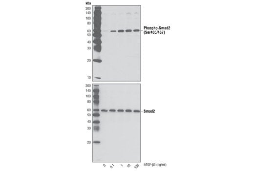 undefined Image 3: Human Transforming Growth Factor β3 (hTGF-β3)