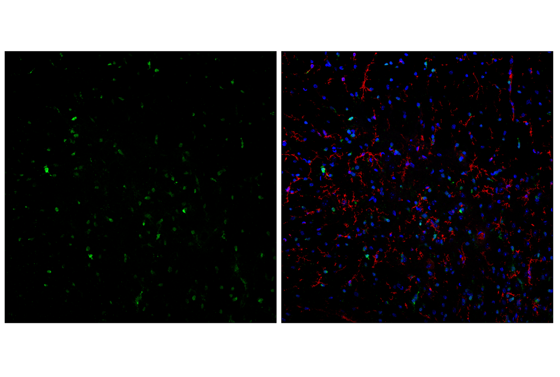 Immunofluorescence Image 2: Olig1 (E3T6D) Rabbit Monoclonal Antibody
