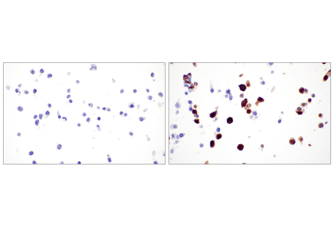 Immunohistochemistry Image 1: T-bet/TBX21 (E4I2K) Rabbit Monoclonal Antibody (BSA and Azide Free)