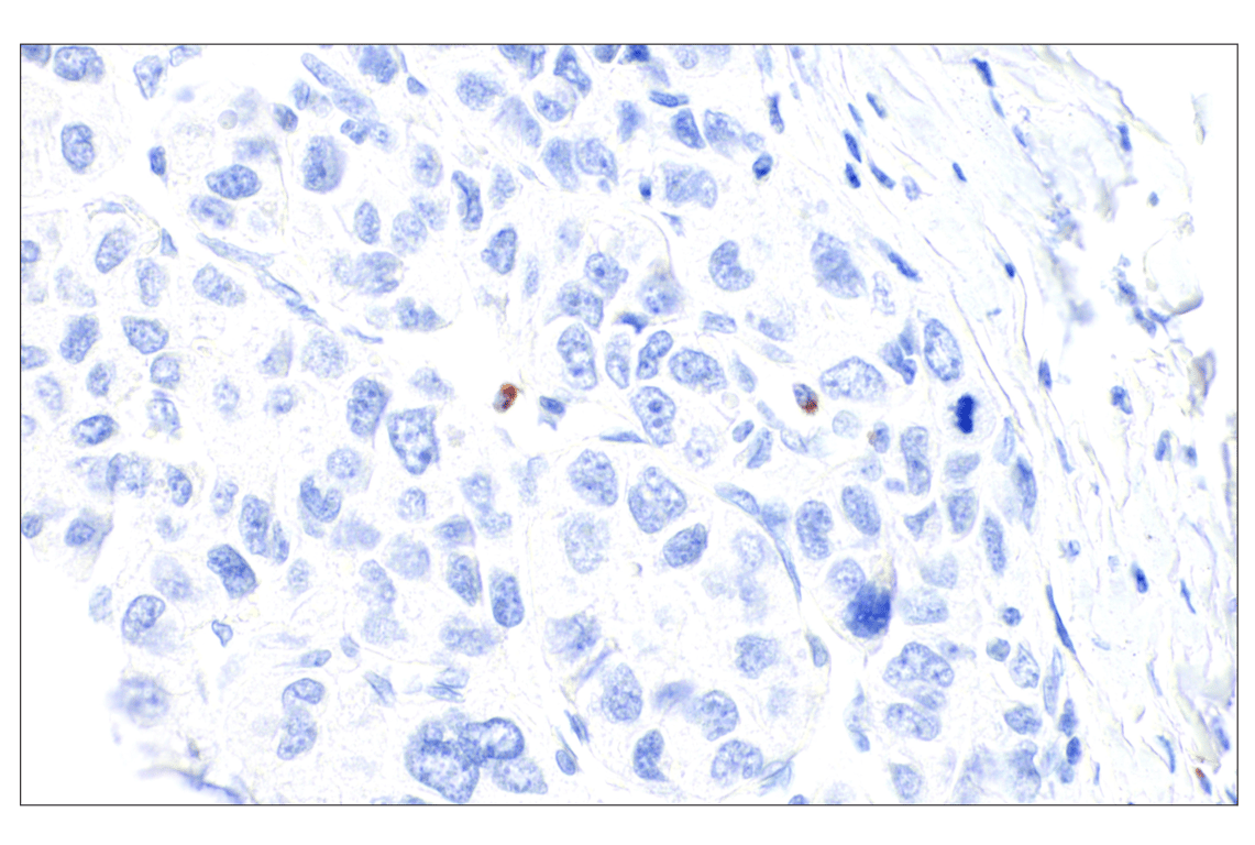 Immunohistochemistry Image 5: Perforin (IHC646) Mouse Monoclonal Antibody