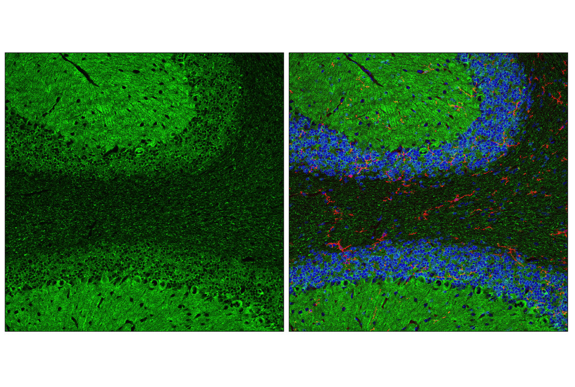 Immunofluorescence Image 2: Tau (D1M9X) XP<sup>®</sup> Rabbit mAb (BSA and Azide Free)