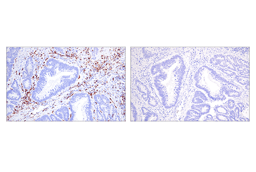Immunohistochemistry Image 3: Iba1/AIF-1 (E5N4J) Mouse Monoclonal Antibody