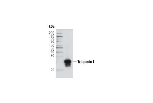 Western Blotting Image 2: Troponin I Antibody
