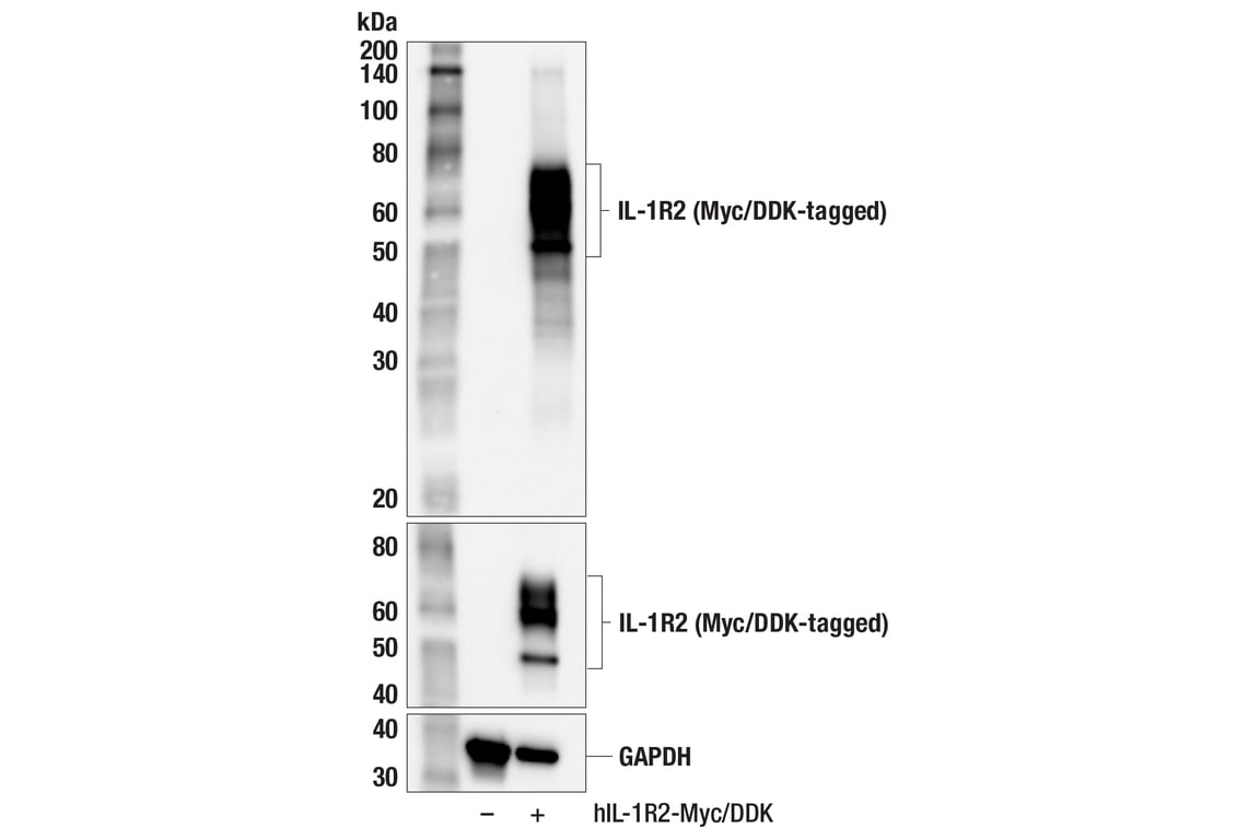 Western Blotting Image 2: IL-1R2 (F5S6U) Rabbit Monoclonal Antibody