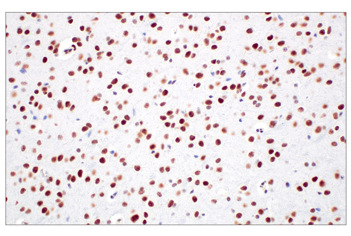 Immunohistochemistry Image 11: CBX7 (E7N1W) Rabbit Monoclonal Antibody