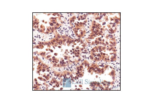 Immunohistochemistry Image 2: Phospho-Akt (Ser473) (736E11) Rabbit Monoclonal Antibody