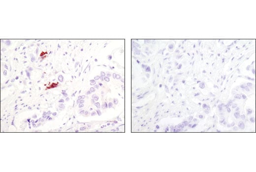 Immunohistochemistry Image 2: LC3A (D50G8) Rabbit Monoclonal Antibody