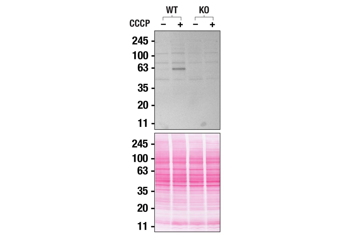 undefined Image 21: Mitophagy Antibody Sampler Kit