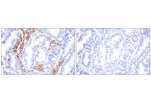Immunohistochemistry Image 3: SLAMF6/CD352 (E3H1E) Rabbit Monoclonal Antibody (BSA and Azide Free)
