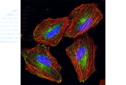 Immunofluorescence Image 1: Rab11a Antibody