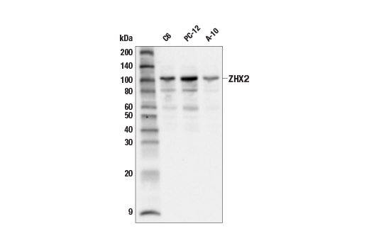 Western Blotting Image 2: ZHX2 (E5H5G) Rabbit Monoclonal Antibody
