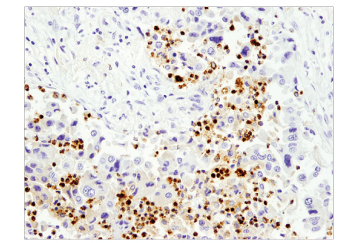 undefined Image 14: NETosis Antibody Sampler Kit