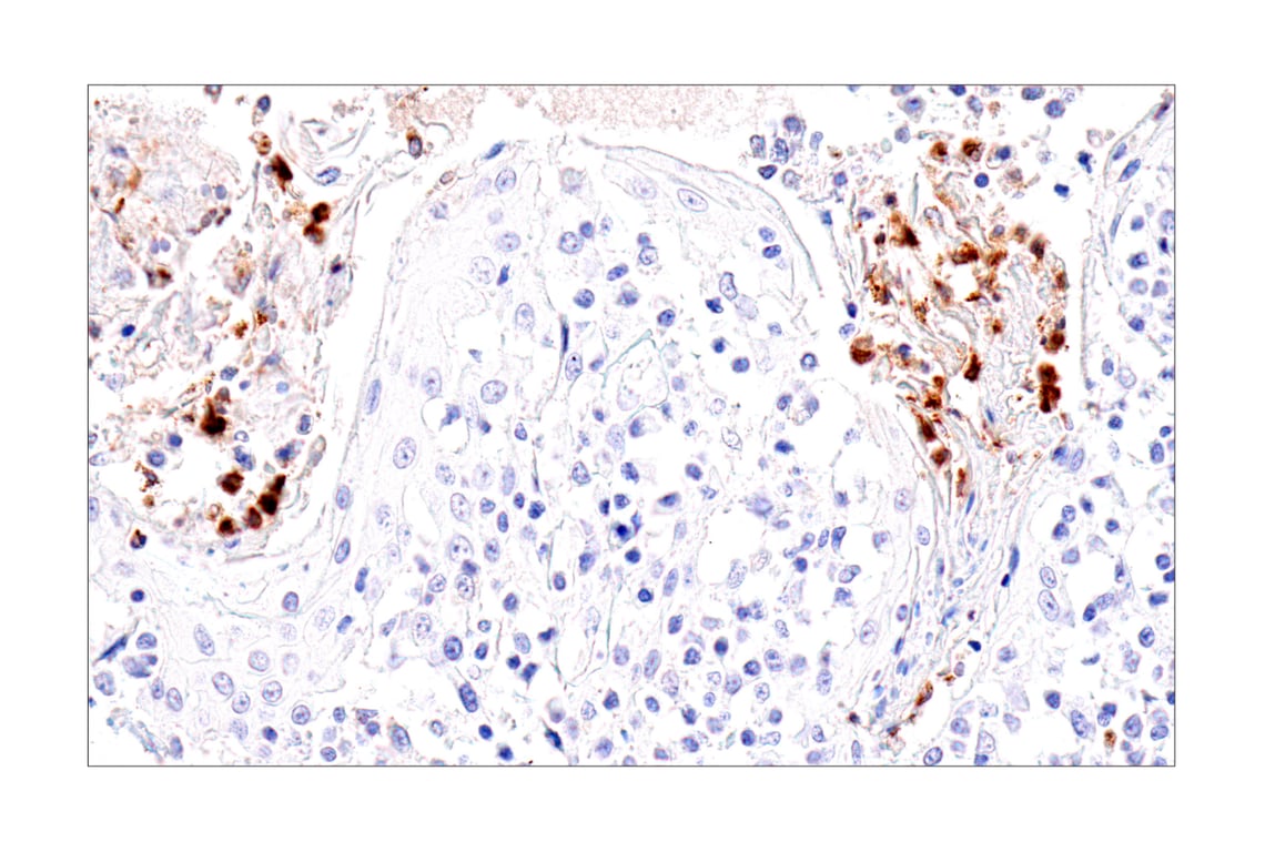 Immunohistochemistry Image 4: IL-8 (E5F5Q) Rabbit Monoclonal Antibody